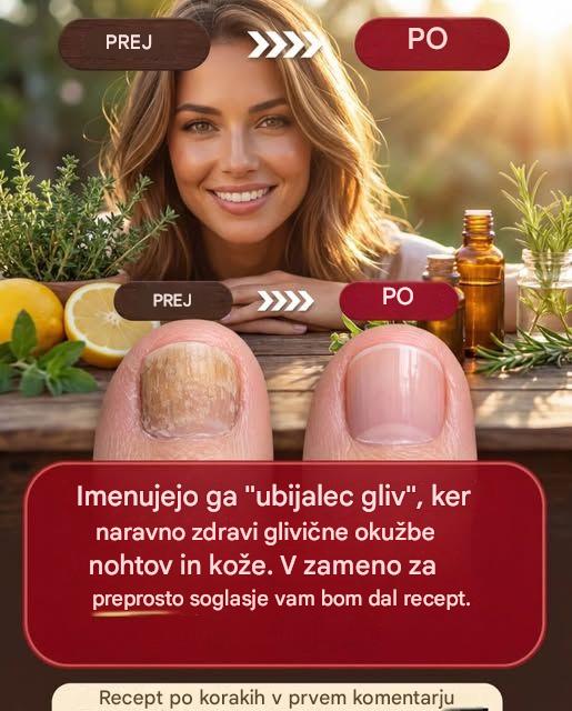 Klinčki za odpravo glivic na nohtih in koži: učinkovita domača zdravila
