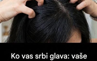 Vas srbi lasišče? Razložili vam bomo vzroke težave.