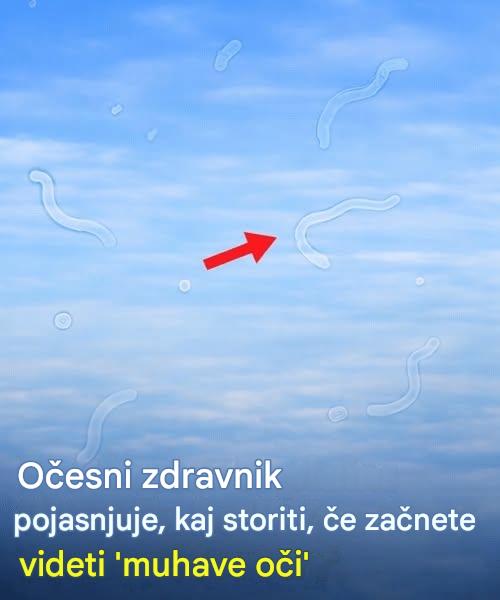 Kaj storiti, če se vam začnejo pojavljati muhe v očeh: koristen vodnik za oftalmologa